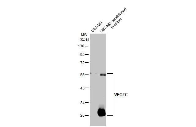 VEGFC Antibody in Western Blot (WB)