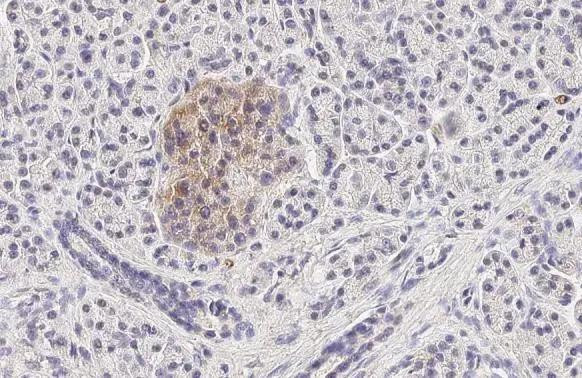 GLP1R Antibody in Immunohistochemistry (Paraffin) (IHC (P))