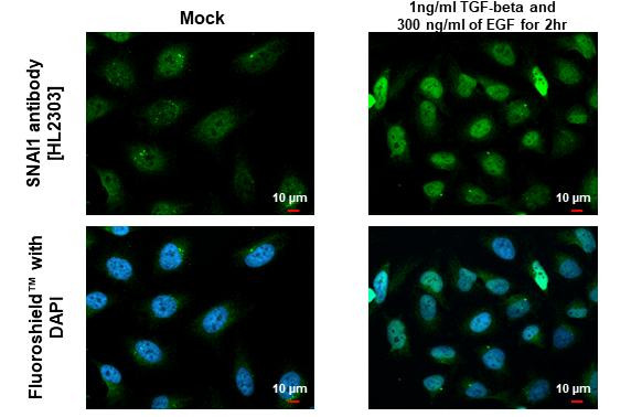 SNAIL Antibody in Immunocytochemistry (ICC/IF)