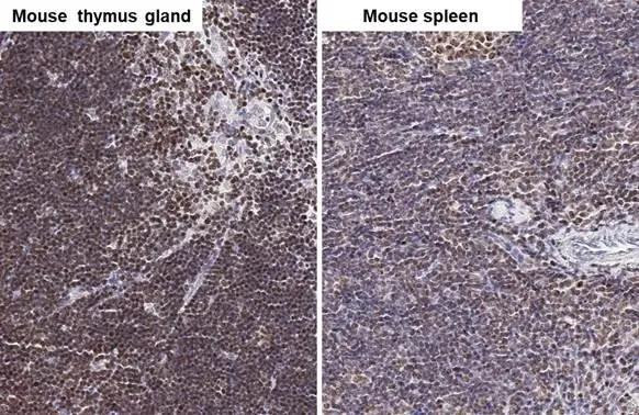 ARID1A Antibody in Immunohistochemistry (Paraffin) (IHC (P))