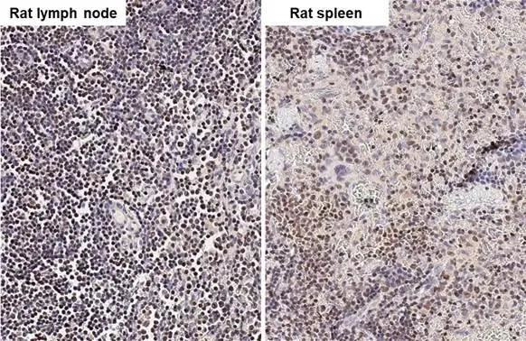 ARID1A Antibody in Immunohistochemistry (Paraffin) (IHC (P))