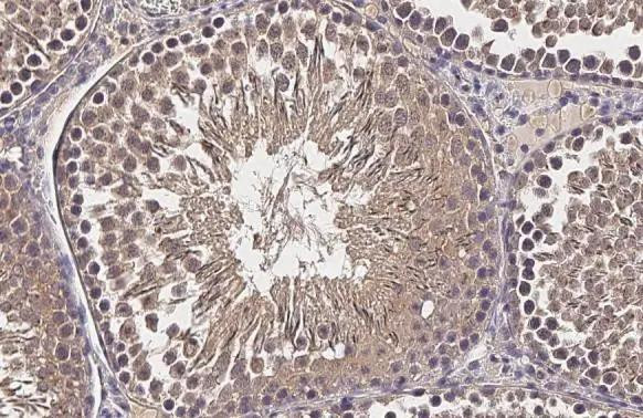 CP110 Antibody in Immunohistochemistry (Paraffin) (IHC (P))