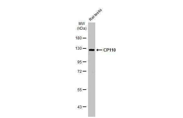 CP110 Antibody in Western Blot (WB)