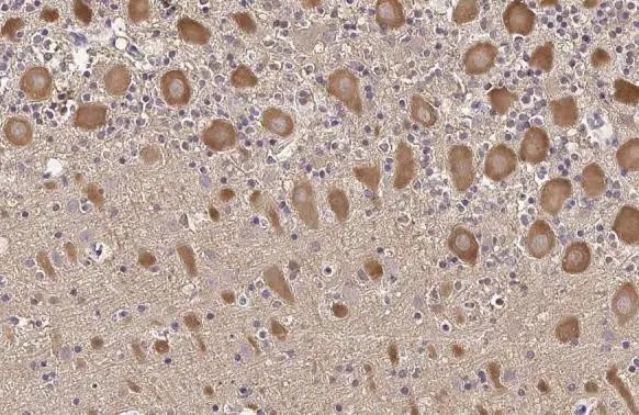 TLR3 Antibody in Immunohistochemistry (Paraffin) (IHC (P))