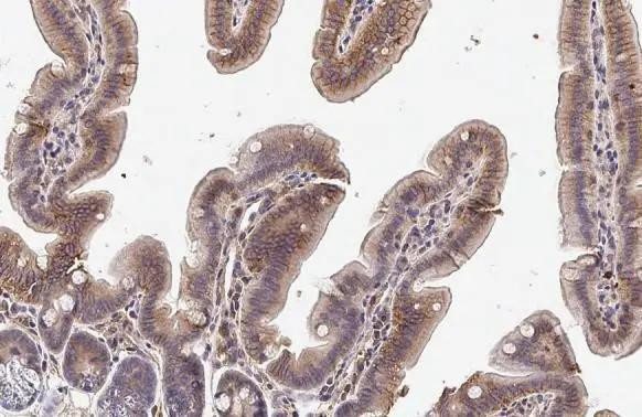 TLR3 Antibody in Immunohistochemistry (Paraffin) (IHC (P))