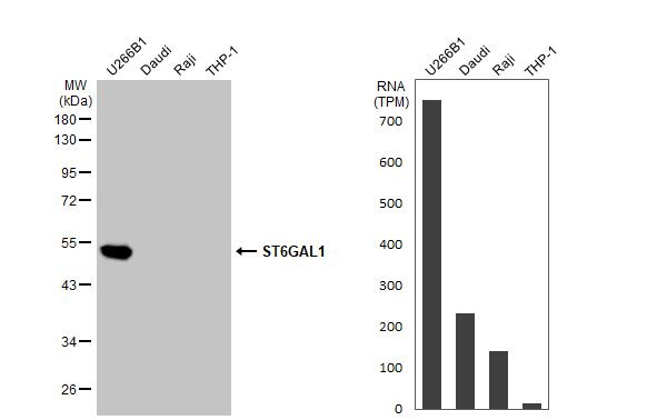 ST6GAL1 Antibody in Western Blot (WB)