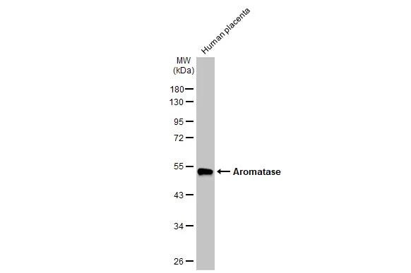 Aromatase Antibody in Western Blot (WB)