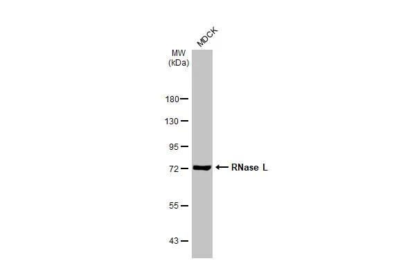 RNaseL Antibody in Western Blot (WB)