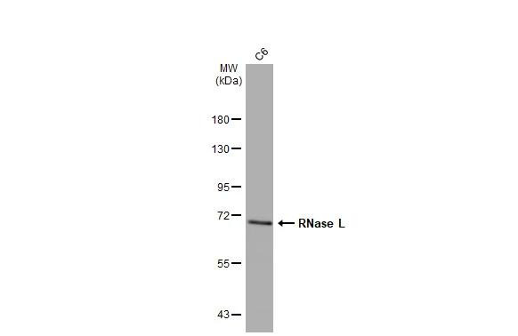 RNaseL Antibody in Western Blot (WB)