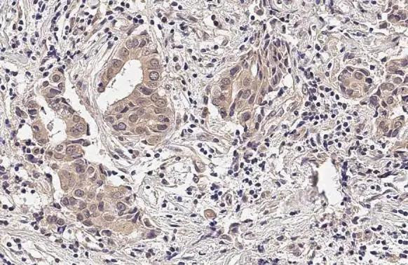 RNaseH1 Antibody in Immunohistochemistry (Paraffin) (IHC (P))