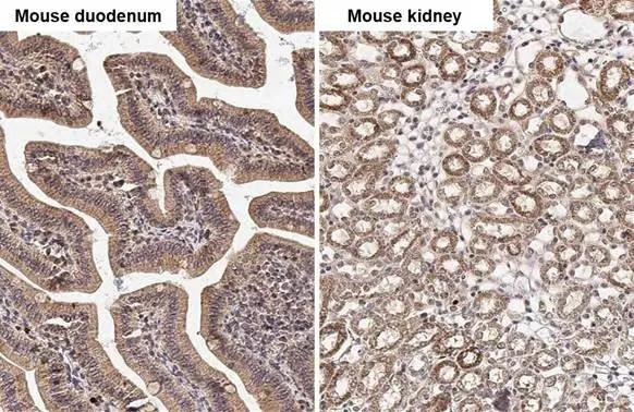 PELO Antibody in Immunohistochemistry (Paraffin) (IHC (P))