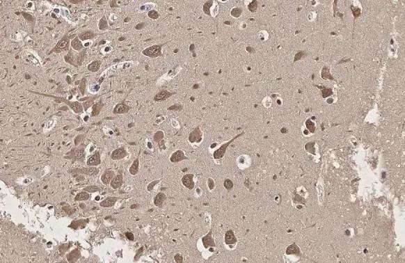 SERCA2 ATPase Antibody in Immunohistochemistry (Paraffin) (IHC (P))