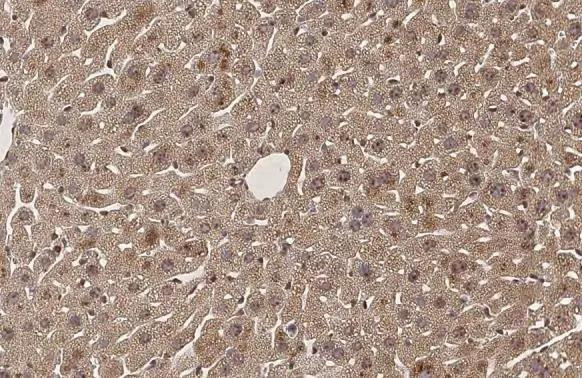 SERCA2 ATPase Antibody in Immunohistochemistry (Paraffin) (IHC (P))