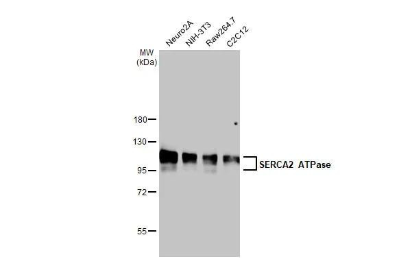 SERCA2 ATPase Antibody in Western Blot (WB)