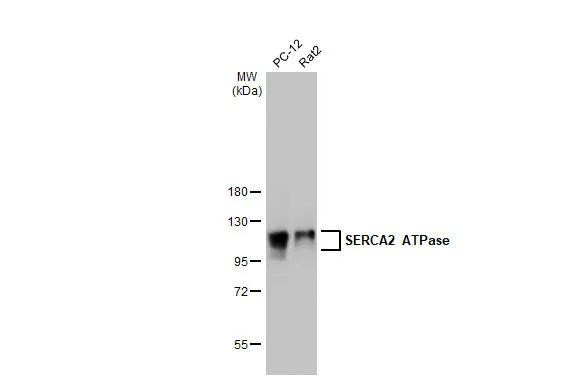 SERCA2 ATPase Antibody in Western Blot (WB)