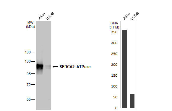 SERCA2 ATPase Antibody in Western Blot (WB)