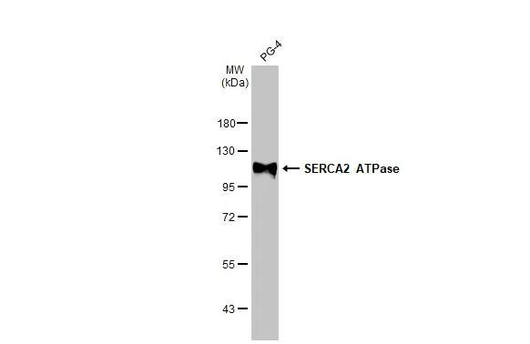 SERCA2 ATPase Antibody in Western Blot (WB)