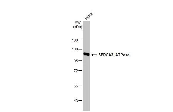 SERCA2 ATPase Antibody in Western Blot (WB)