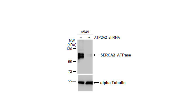 SERCA2 ATPase Antibody in Western Blot (WB)