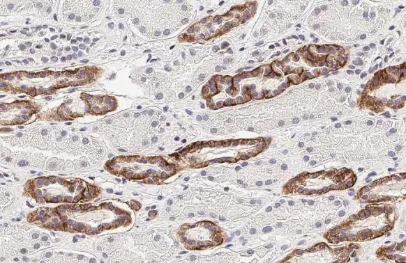 Calcium Sensing Receptor Antibody in Immunohistochemistry (Paraffin) (IHC (P))