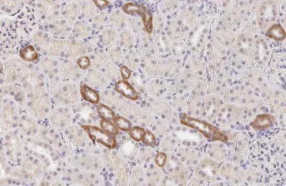 Calcium Sensing Receptor Antibody in Immunohistochemistry (Paraffin) (IHC (P))