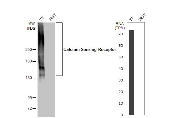 Calcium Sensing Receptor Antibody in Western Blot (WB)