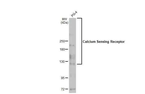 Calcium Sensing Receptor Antibody in Western Blot (WB)