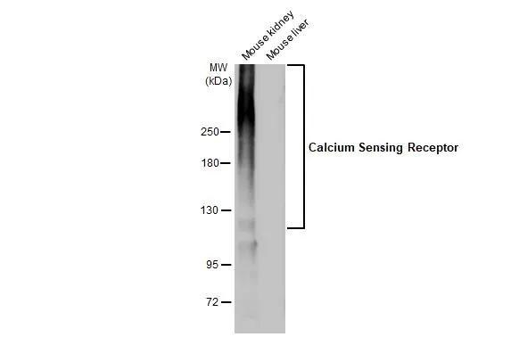 Calcium Sensing Receptor Antibody in Western Blot (WB)