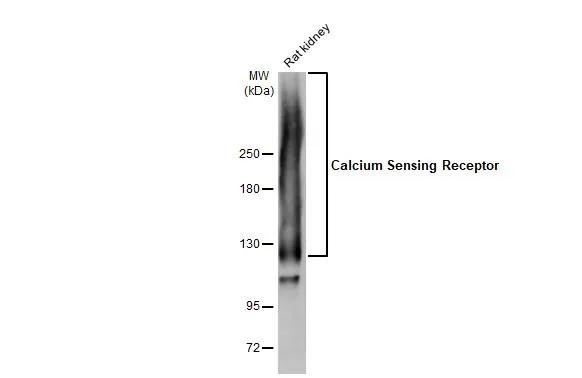 Calcium Sensing Receptor Antibody in Western Blot (WB)