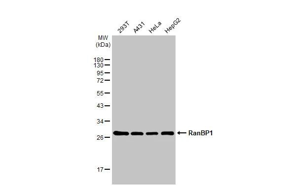 RANBP1 Antibody in Western Blot (WB)