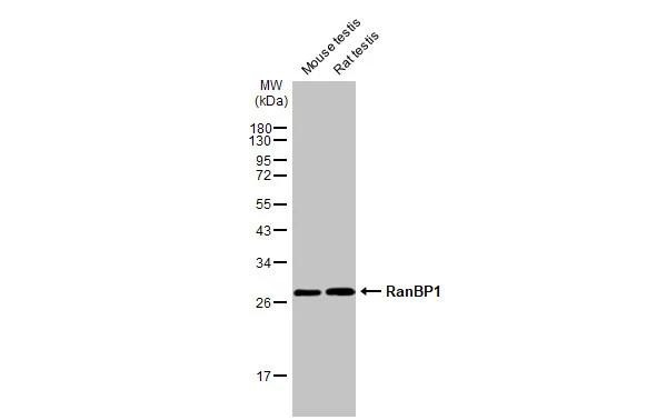 RANBP1 Antibody in Western Blot (WB)