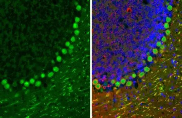 Calbindin D28K Antibody in Immunohistochemistry (Paraffin) (IHC (P))