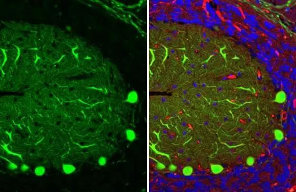 Calbindin D28K Antibody in Immunohistochemistry (Paraffin) (IHC (P))