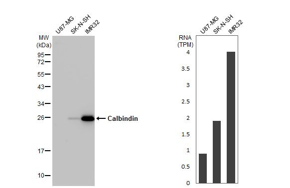 Calbindin D28K Antibody in Western Blot (WB)