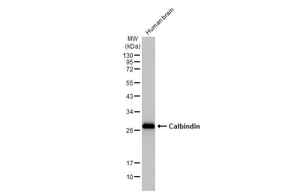 Calbindin D28K Antibody in Western Blot (WB)