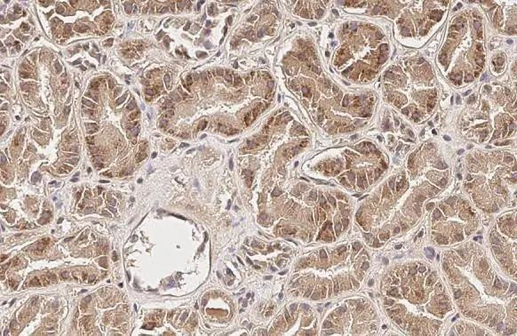 SUCLG1 Antibody in Immunohistochemistry (Paraffin) (IHC (P))