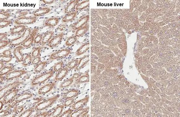 SUCLG1 Antibody in Immunohistochemistry (Paraffin) (IHC (P))