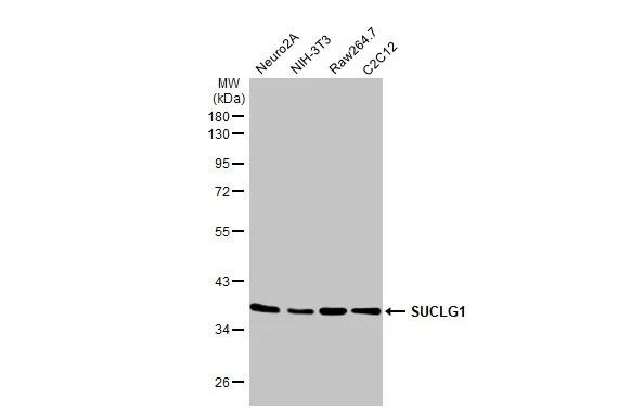 SUCLG1 Antibody in Western Blot (WB)