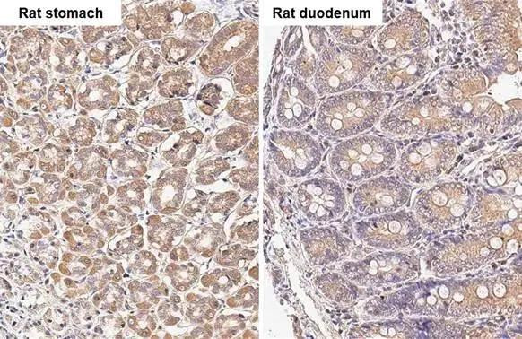 TBC1D5 Antibody in Immunohistochemistry (Paraffin) (IHC (P))