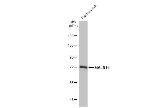 GALNT6 Antibody in Western Blot (WB)