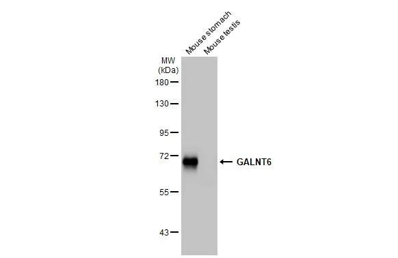 GALNT6 Antibody in Western Blot (WB)