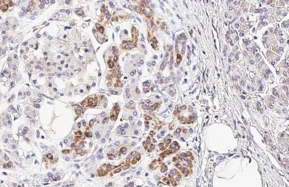 CXCR4 Antibody in Immunohistochemistry (Paraffin) (IHC (P))