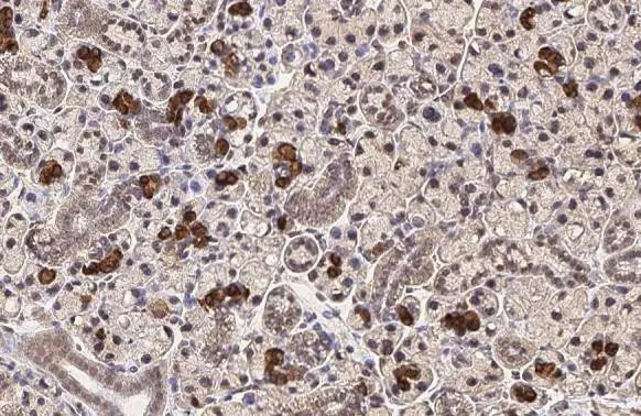 CXCR4 Antibody in Immunohistochemistry (Paraffin) (IHC (P))