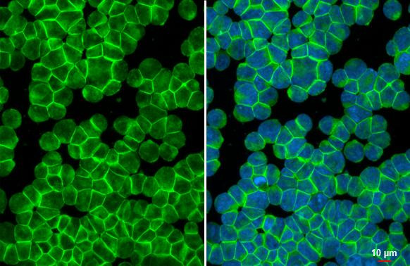 CXCR4 Antibody in Immunocytochemistry (ICC/IF)