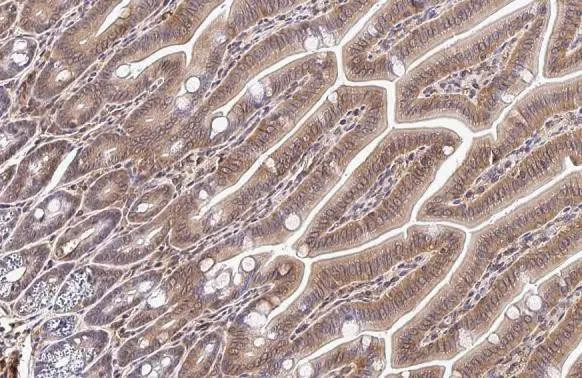 CXCR4 Antibody in Immunohistochemistry (Paraffin) (IHC (P))