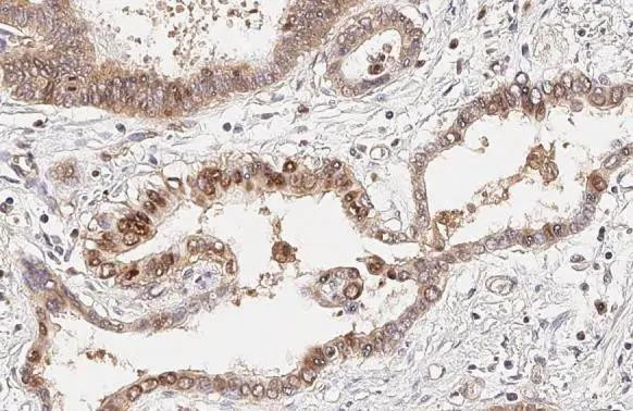 CXCR4 Antibody in Immunohistochemistry (Paraffin) (IHC (P))