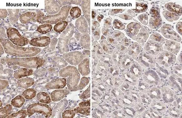 Calpain 5 Antibody in Immunohistochemistry (Paraffin) (IHC (P))