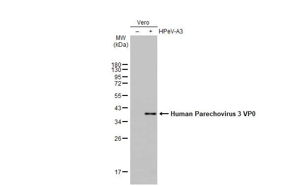 Human Parechovirus Type 1/3 VP0 Antibody in Western Blot (WB)