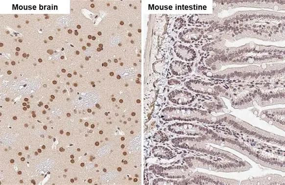 FUS Antibody in Immunohistochemistry (Paraffin) (IHC (P))