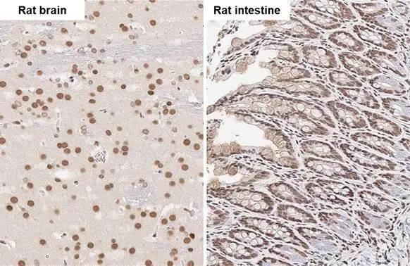 FUS Antibody in Immunohistochemistry (Paraffin) (IHC (P))